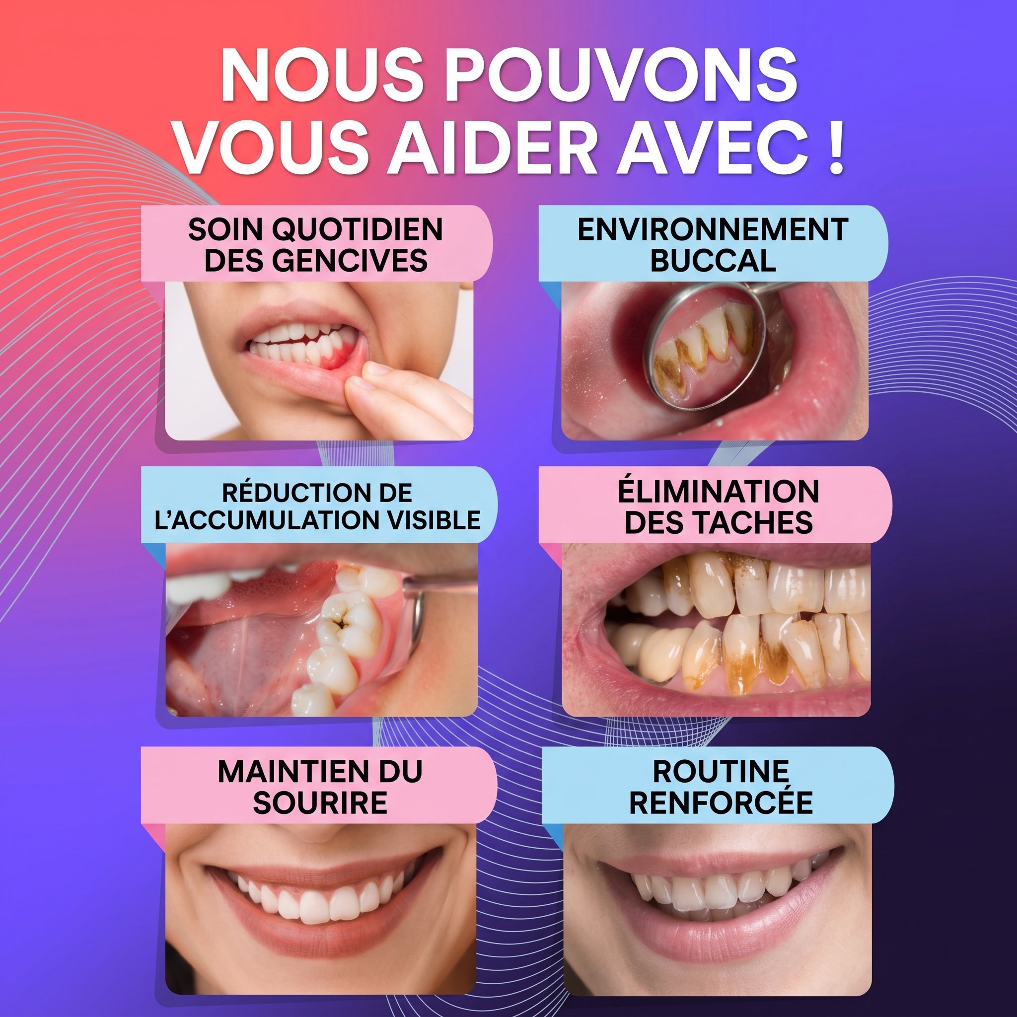 Détartreur Dentaire à Ultrasons